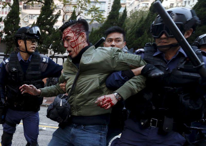 An unidentified injured man is escorted by riot police at Mongkok in Hong Kong, China February 9, 2016. REUTERS/Bobby Yip