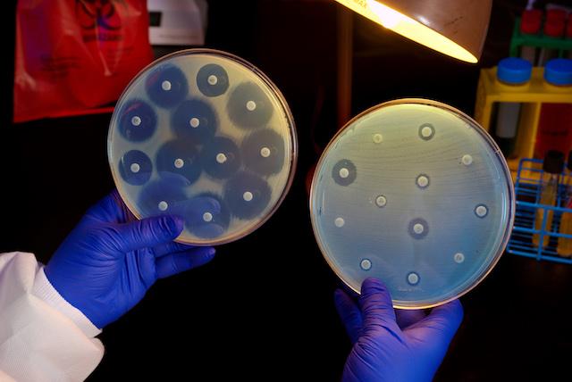 Drug-resistant superbug cause for concern in US